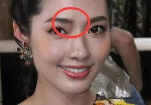 脸上有疤痕的女明星,揭秘那些勇敢面对挑战的女明星