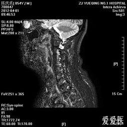 颈椎看啥料,揭秘身体健康的密码