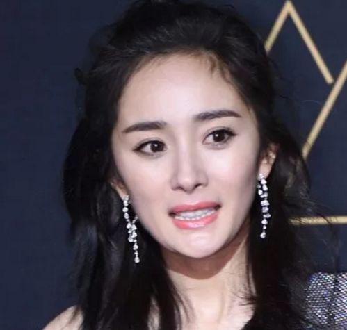 娱乐圈皮肤不好的明星