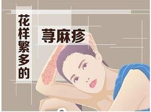 有哪个明星得荨麻疹,揭秘明星健康背后的挑战